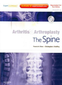 Arthritis and arthroplasty the spine