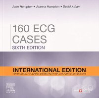 Image of 160 ECG cases