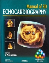 Manual of 3D Echocardiography