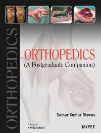 Image of Orthopedics : a postgraduate companion