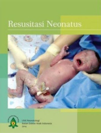 Resusitasi neonatus