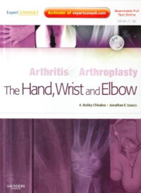 Arthritis and arthroplasty the hand, wrist and elbow