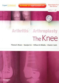 Arthritis and arthroplasty the knee