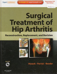 Surgical treatment of hip arthritis : reconstruction, replacement, and revision